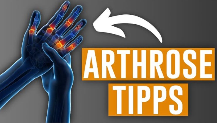 Bestrahlung Bei Arthrose In Den Händen premium.liebscher-bracht.com