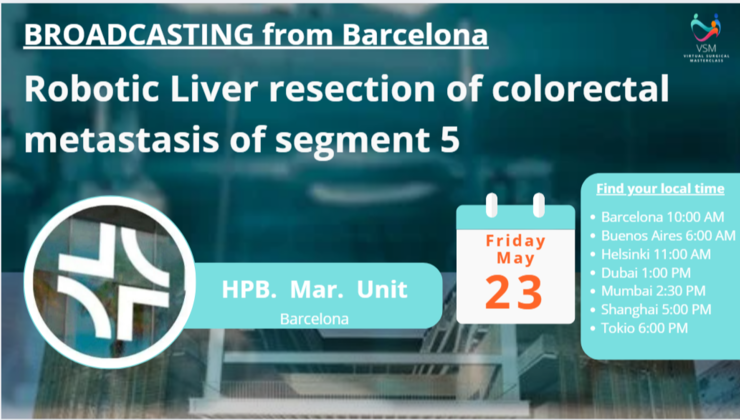 Robotic Liver Resection Of Colorectal Metastasis Of Segment 5