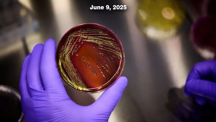 The "Superbug" Threat in the Austin Context