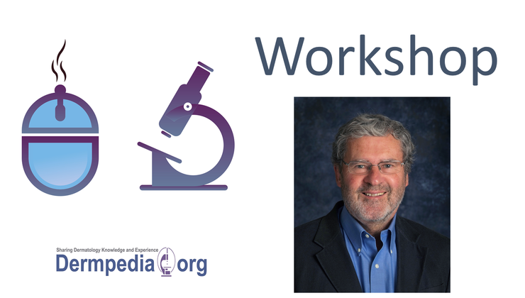 Workshop on Dysplastic Nevus Part I | Dermpedia