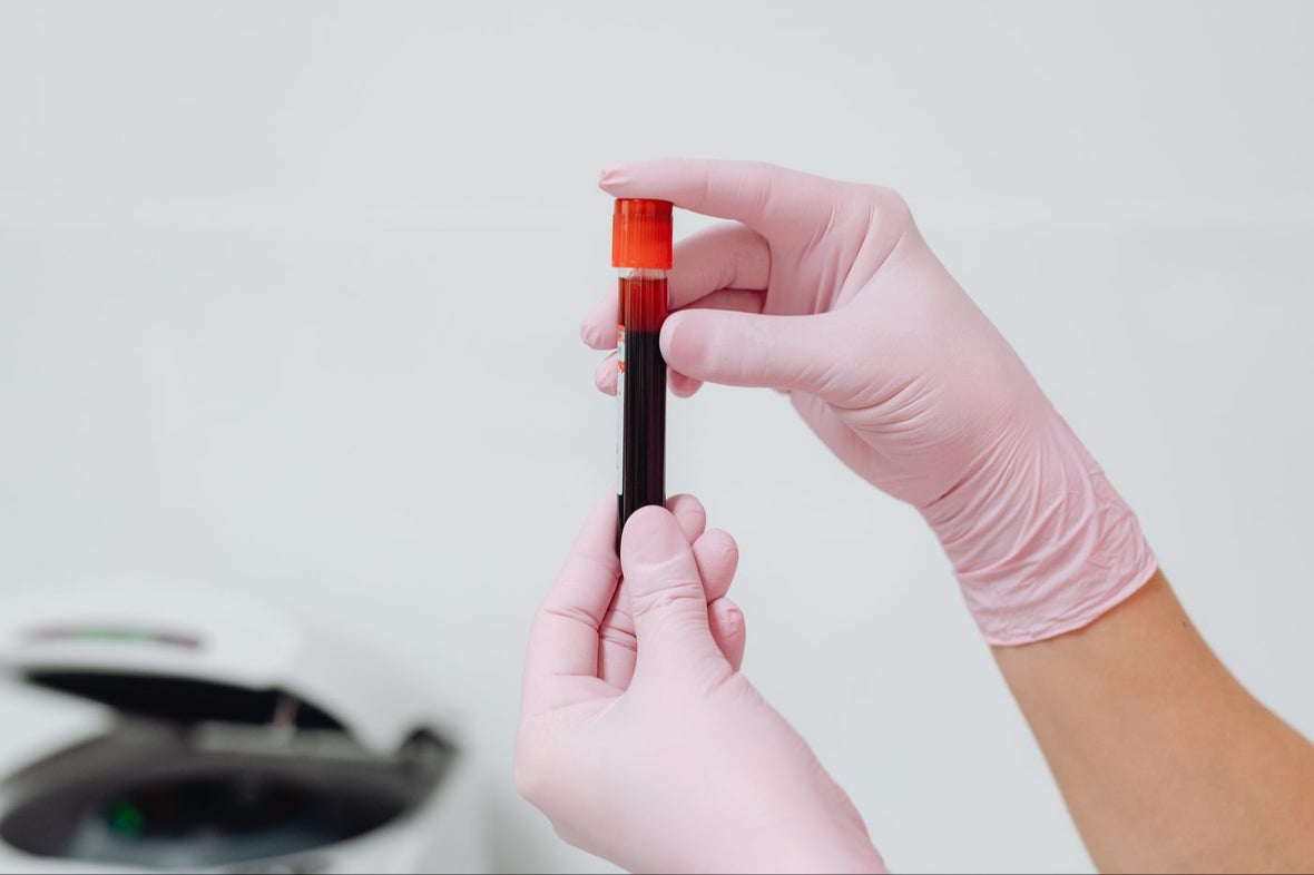 Advanced functional diagnostics