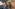 Peter Achola's smothered jiggers removed (Sept 19th 2025)