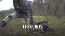 Leg Splints