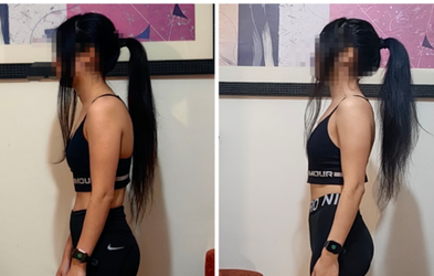 Antes y después de postura de una alumna