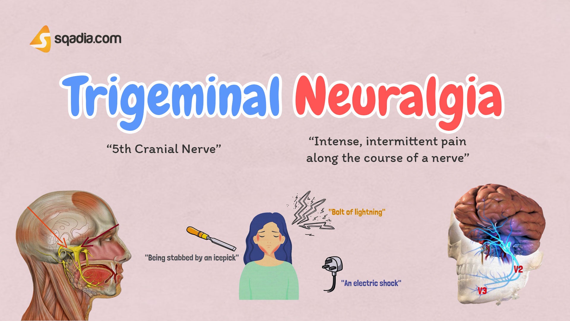 Trigeminal Neuralgia