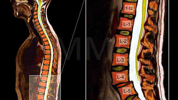 Intro Video Lumbar 