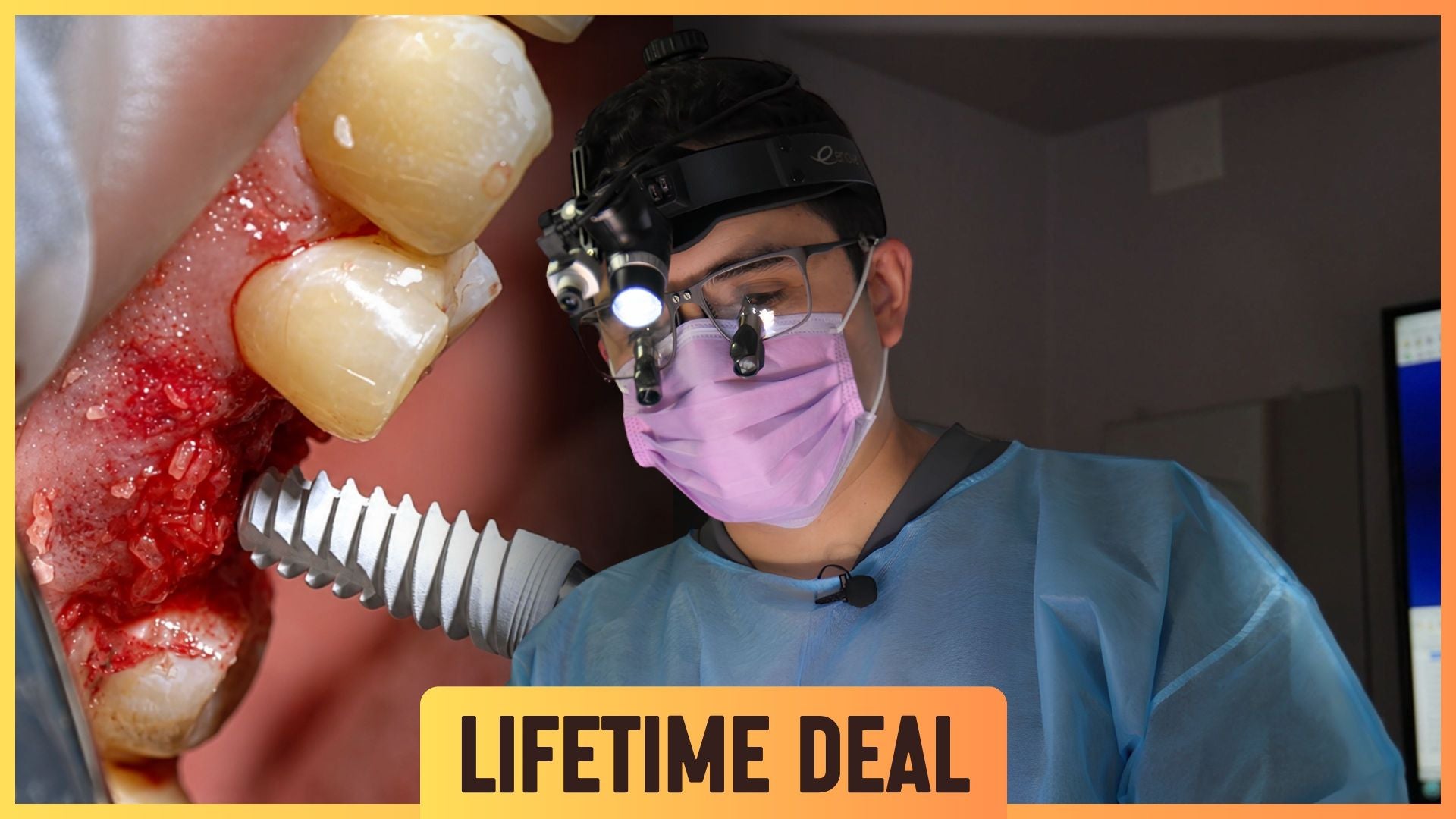 Founder's Lifetime Deal