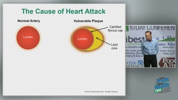 High Blood Pressure Medications, The Cause Of Heart Attacks, Stents with Joel Fuhrman, M.D.