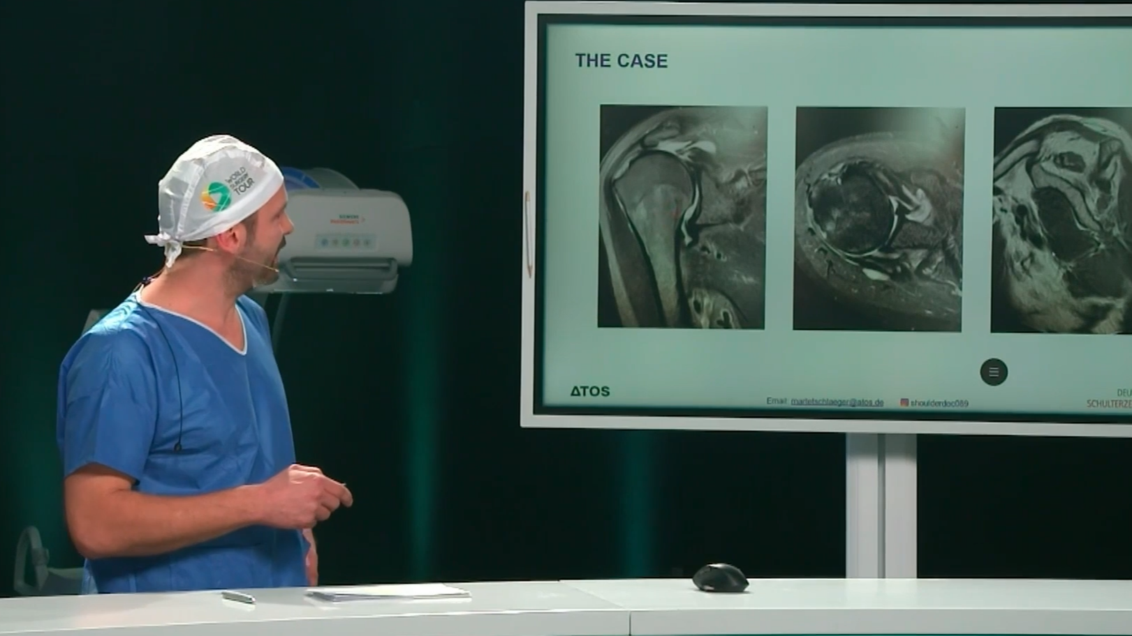 Case Introduction Partial Rotator Cuff Repair & Balloon Spacer vs