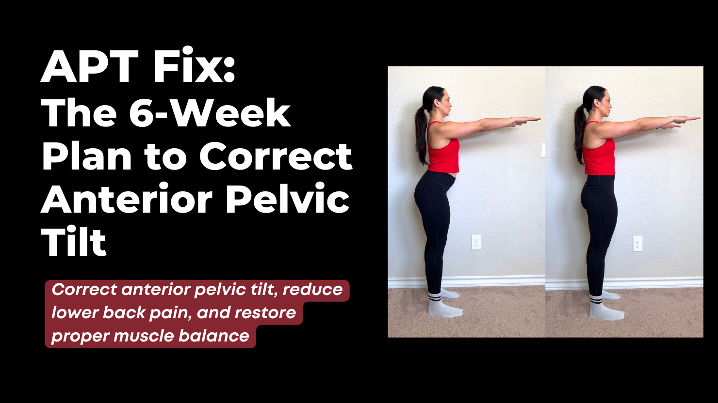 APT Fix: The 6-Week Plan to Correct Anterior Pelvic Tilt