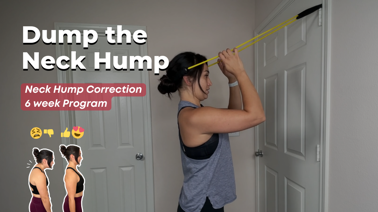 Dump the Neck Hump (Forward Head Posture Fix) - 6 Week Program