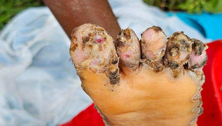 sacai fragment on feet