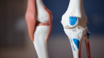 The Arthritic Knee with Matt (4 CECs)
