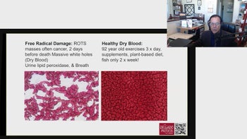 Documentary - Cancer - Part 2 2024