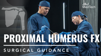 Four-Part Fractures of the Proximal Humerus
