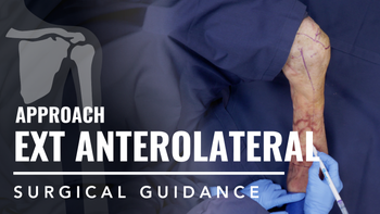 Extended Anterolateral Approach to the Proximal Humerus
