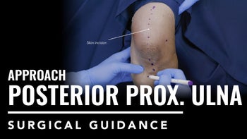 Posterior Approach to the Proximal Ulna
