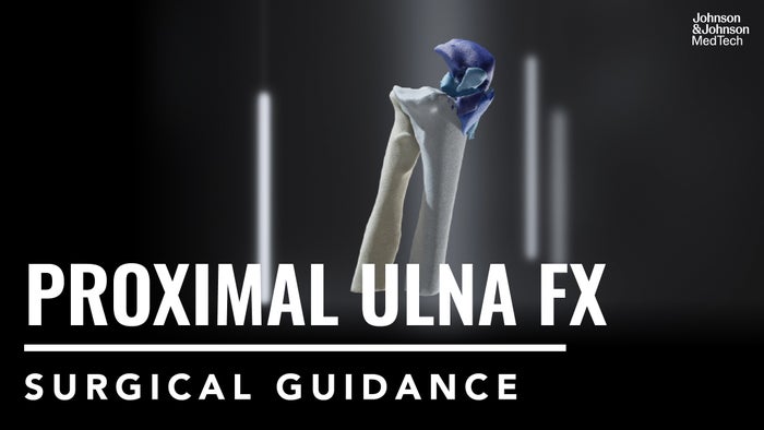 Complete Articular Fractures of the Proximal Ulna