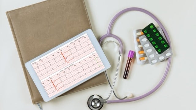 Electrocardiografia aritmiilor