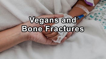 Dr. John A. McDougall Speaks About Vegans and Bone Fractures, Unhealthy Vegans, Carnivorous Diets, Ideal Blood Sugar, Fruit Consumption, Nuts, Seeds, and Avocados - John A. McDougall, M.D.