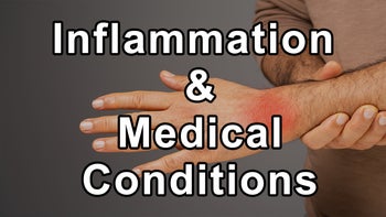 Dr. Jyothi Rao Discusses Why Inflammation Is Crucial As It Plays a Role in Numerous Medical Conditions and Chronic Illnesses, Factors Increasing the Rise in Chronic Illnesses, Sugar Dysregulation and the Increasing Prevalence of Insulin Resistance - Jyothi Rao M.D