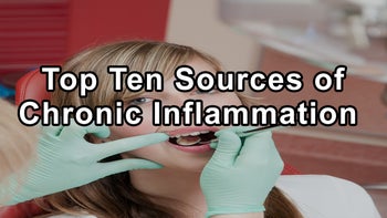 Top Ten Sources of Chronic Inflammation and Toxicity in the Mouth With Holistic Dentist Gerald P. Curatola