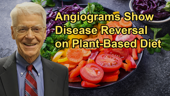 Angiograms Showing Disease Reversal in Patients Following a Plant-Based Diet With Dr. Caldwell B. Esselstyn