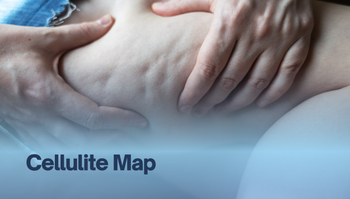 Cellulite Map