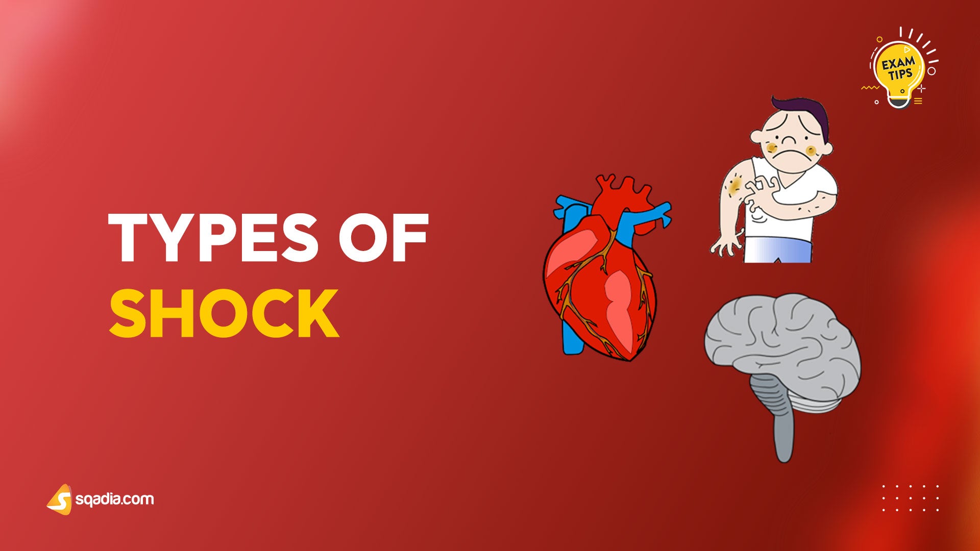 Types of Circulatory Shock Types of Shock
