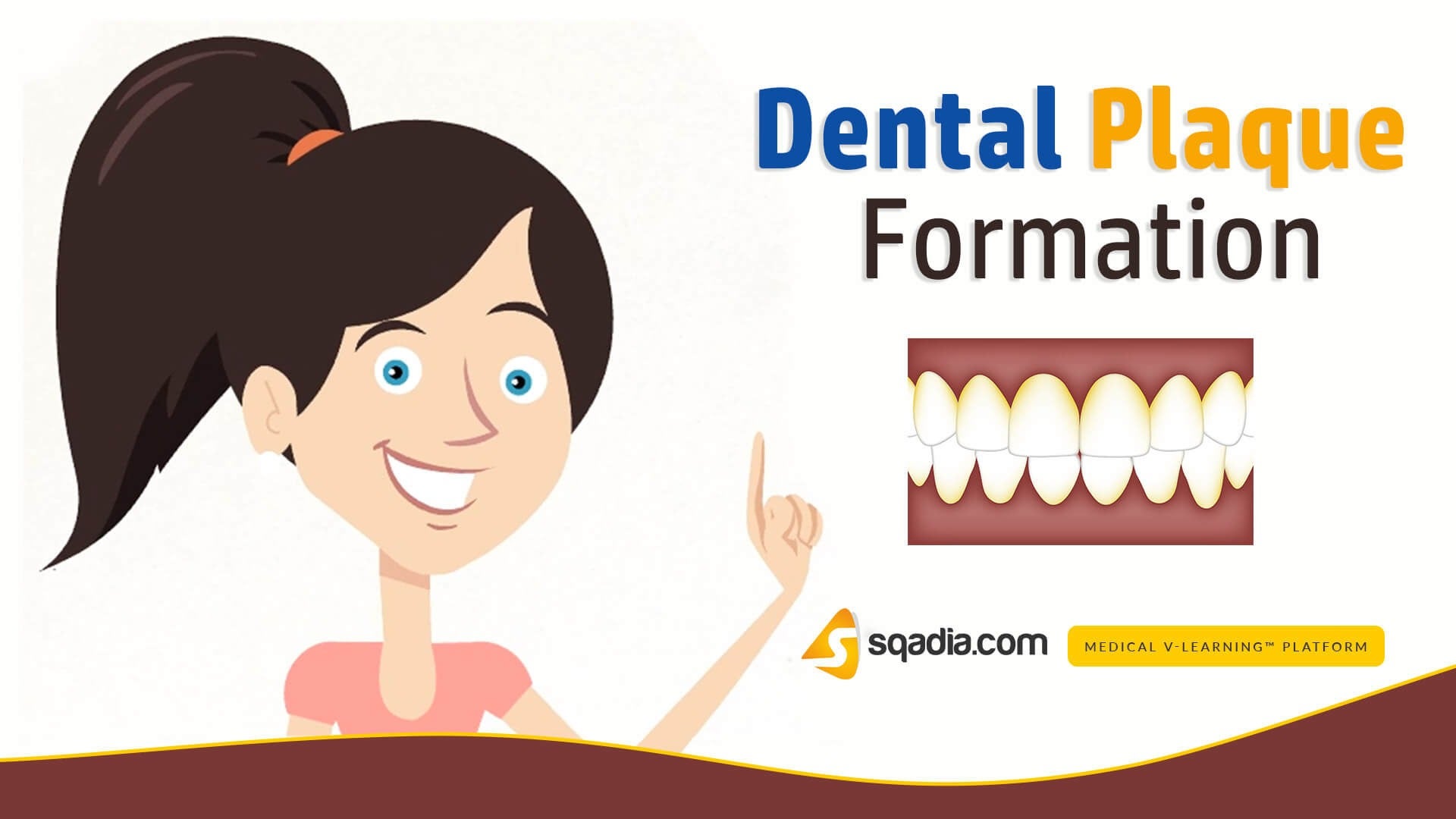 Dental Plaque Formation Pathology Short MD Clip