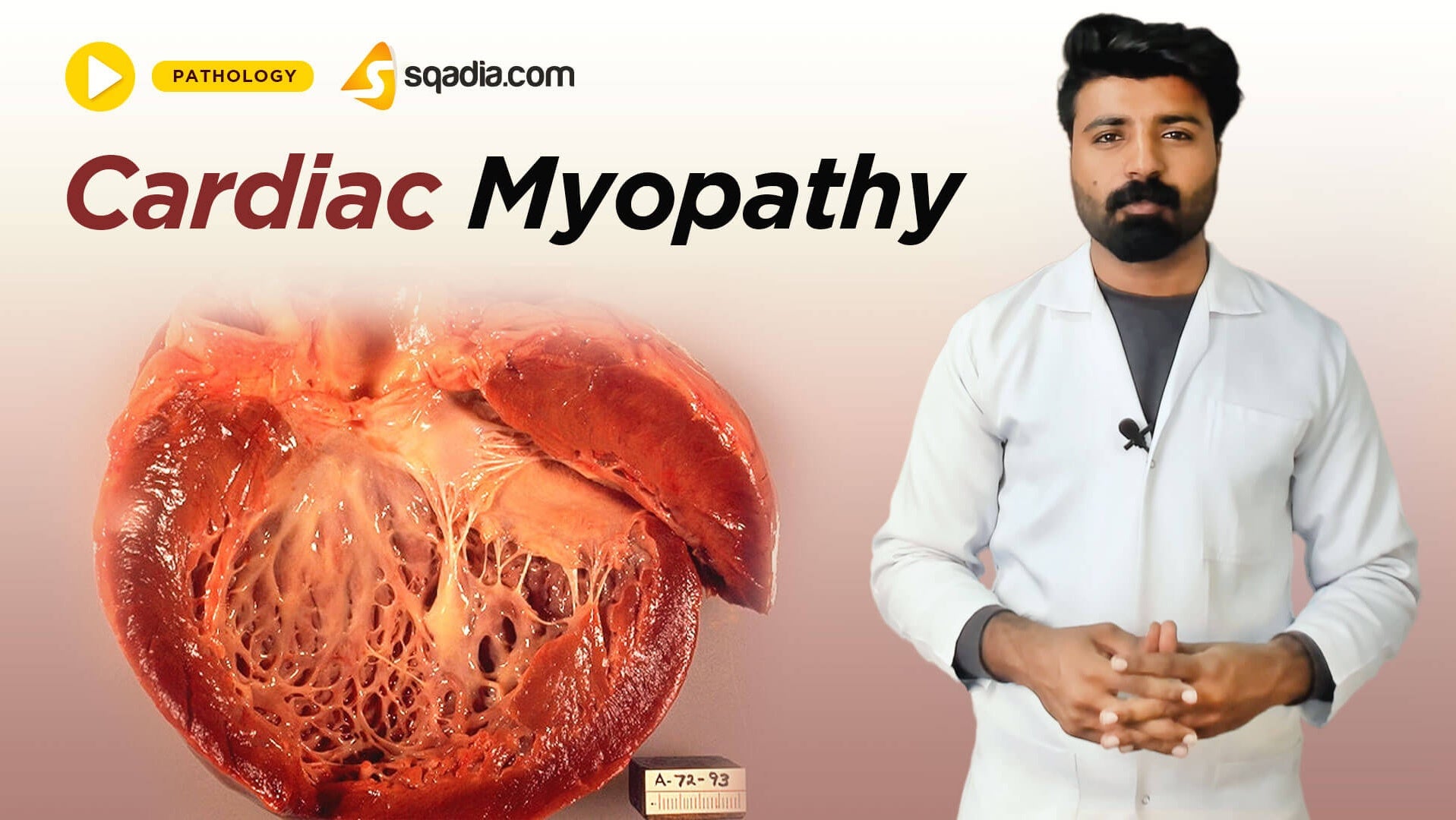 Cardiac Myopathy - Trailer