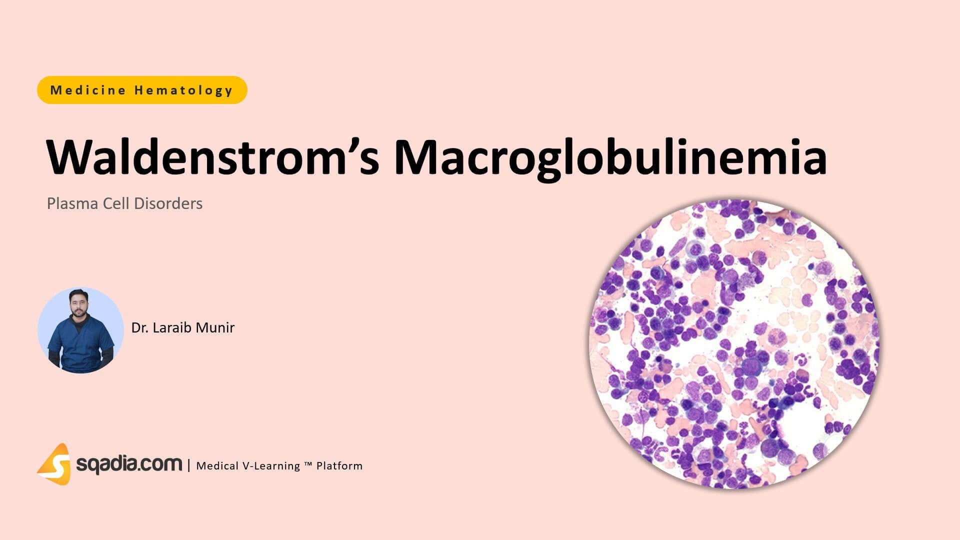 Plasma Cell Disorders Waldenstrom's Macroglobulinemia
