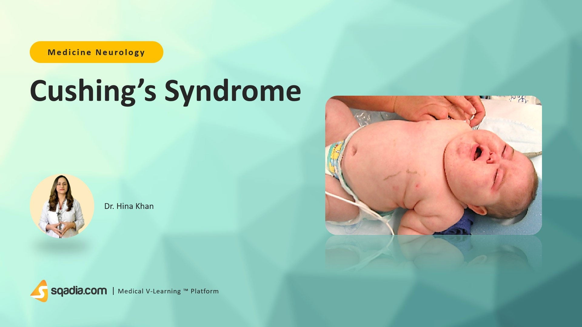 Cushing's Syndrome Introduction