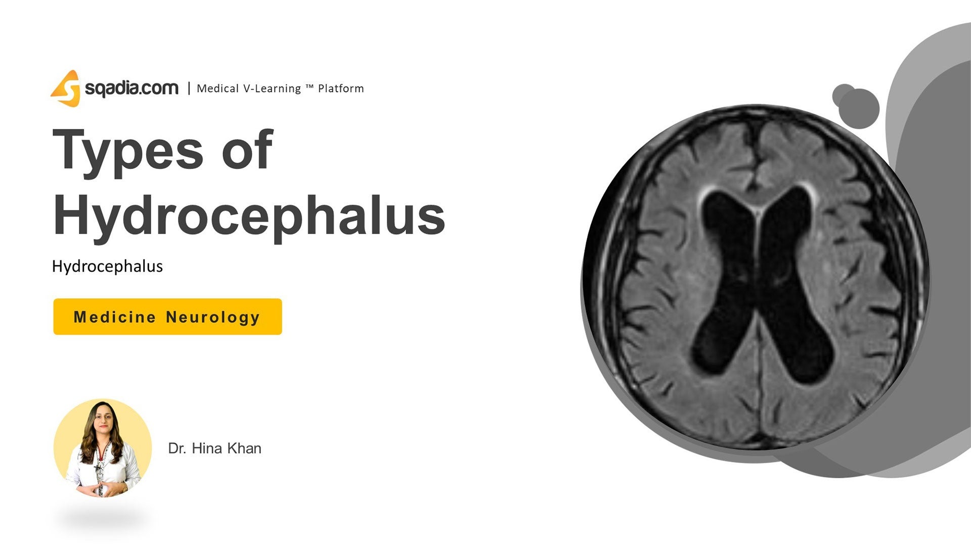 Hydrocephalus Types of Hydrocephalus