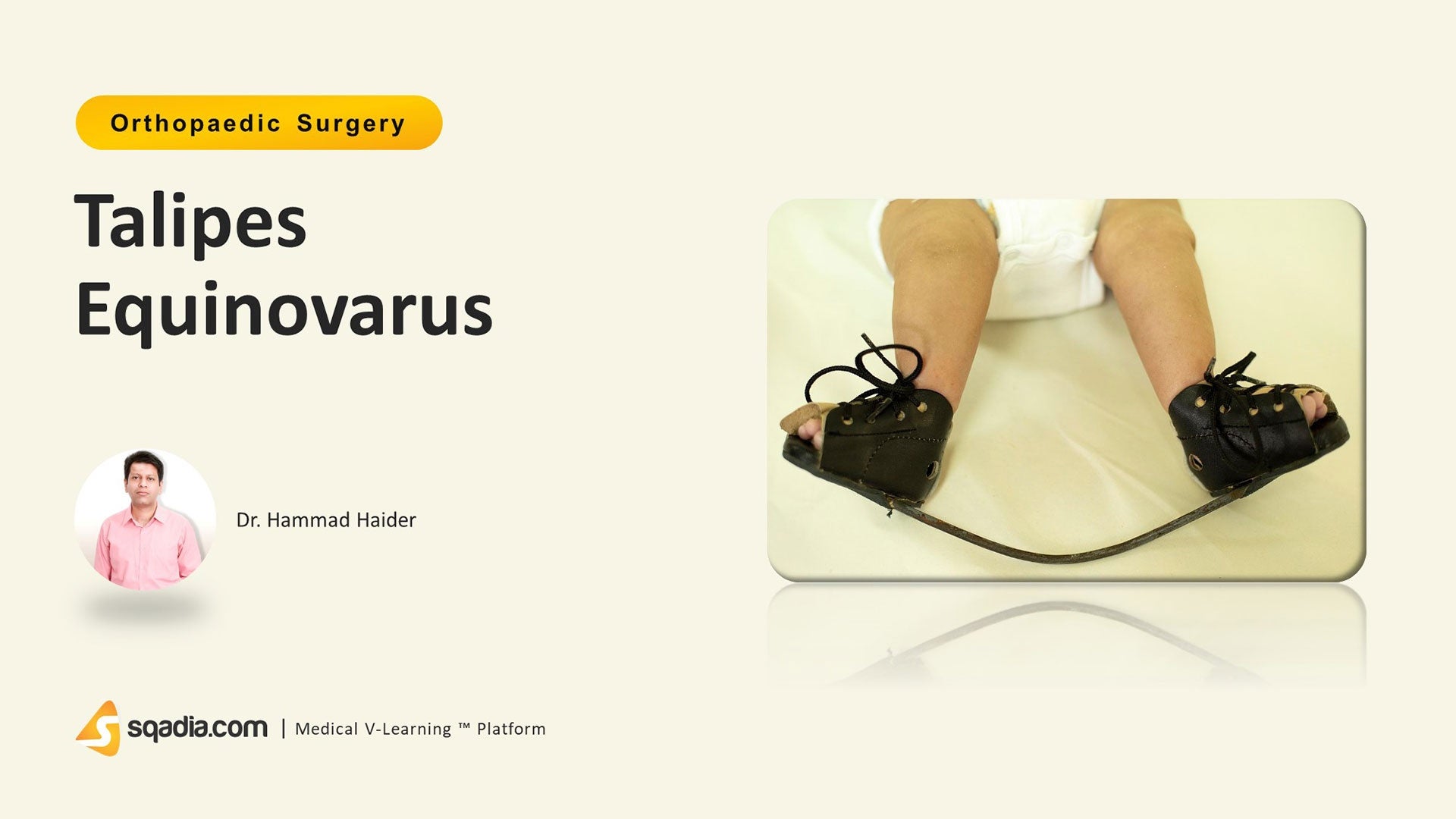 Talipes Equinovarus Introduction